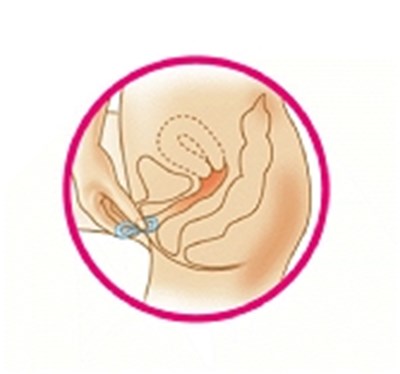 Image Of Diagram 4 (Diagram 4)